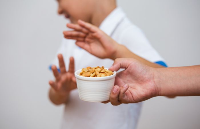Niños alérgicos a alimentos como cacahuetes Niños alérgicos a alimentos