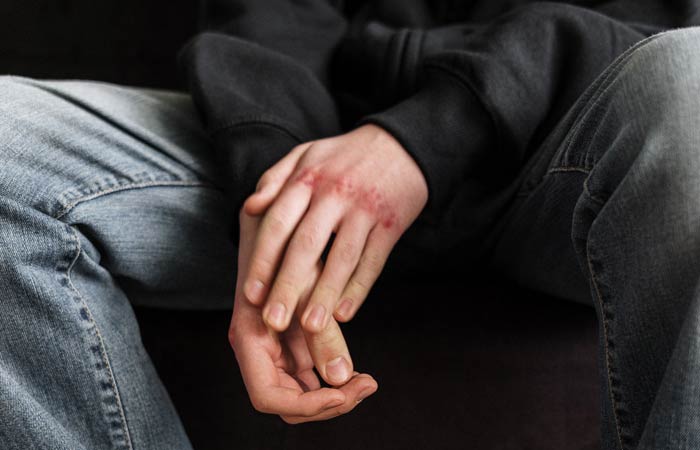 autolesiones en niños y adolescentes