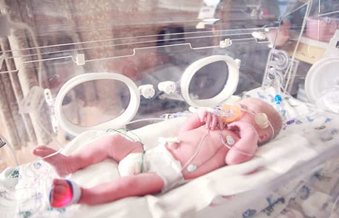 Prematuro neonato