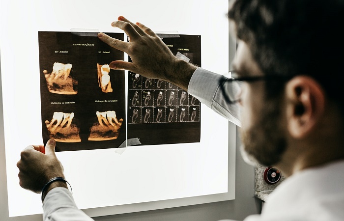 Inteligencia Artificial en el embarazo riesgos