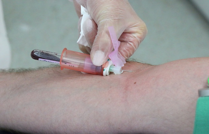 Análisis de sangre para detectar la alergia a los frutos secos