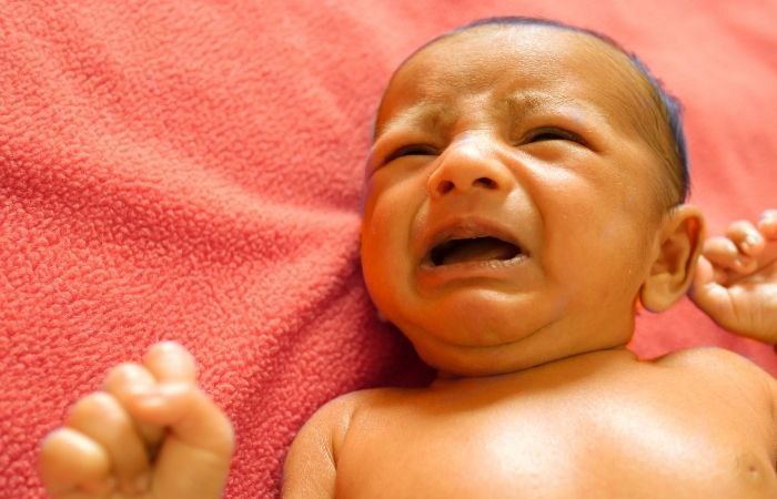 Piel amarillenta, un síntoma de la anemia en prematuros Anemia en bebés prematuros: síntomas