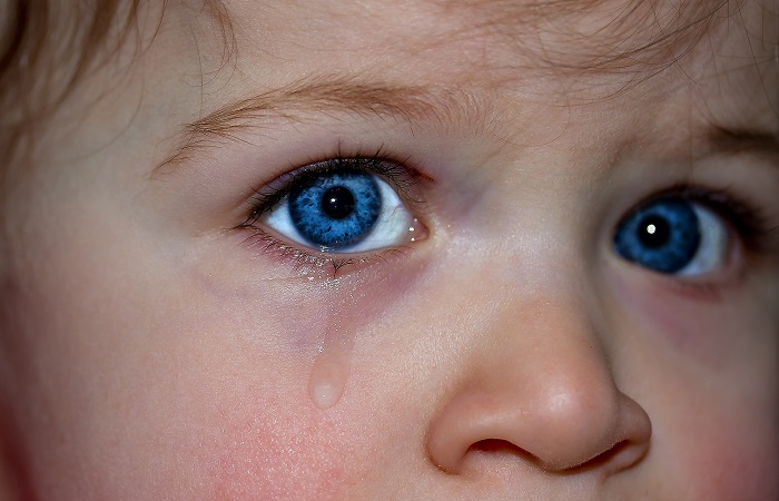 La celulitis preseptal suele afectar a menores de 5 años Celulitis preseptal, más común en niños pequeños