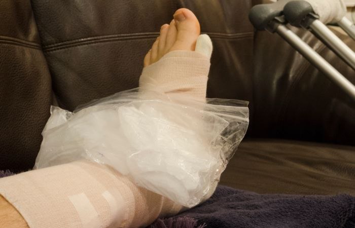 Tratamiento de esguinces mal curados: aplicar hielo para reducir la inflamación Esguinces mal curados: frío local