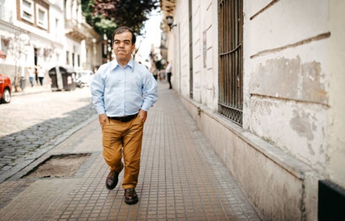 Acondroplasia, causa principal del enanismo Enanismo en niños: acondroplasia