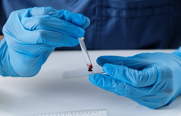 Análisis de sangre para detectar enterocolitis necrotizante Diagnóstico de la enterocolitis necrotizante