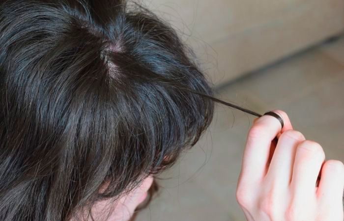 Detrás de la tricotilomanía, sentimiento de estrés y ansiedad tricotilomanía: ansiedad