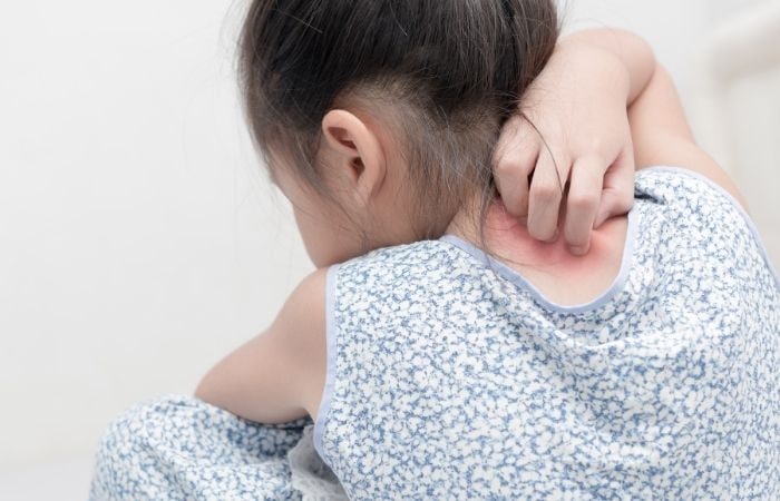La dermatilomanía puede producir infecciones por las heridas que se hacen en la piel Dermatilomanía: niña rascándose el cuello por detrás