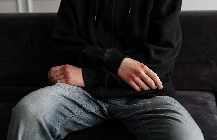 Motivos del parricidio de Elche Incapacidad ante la frustración, motivo del parricidio de Elche