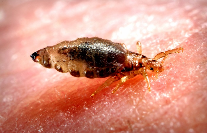 Piojo picando a su huésped Piojo alimentándose