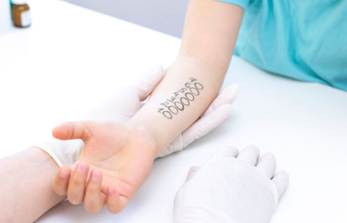 Pruebas de alergia en el brazo de un niño Alergias peligrosas en niños